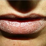 ¿Problemas de labios agrietados? Descubre cómo ponerles solución