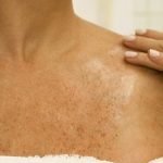 Consejos para evitar la piel seca en el escote